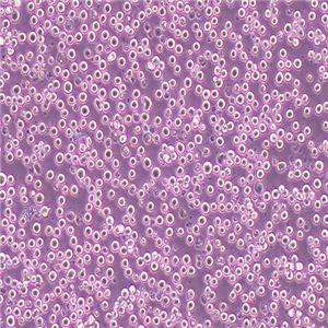 Karpas-299人间变性大细胞淋巴瘤细胞
