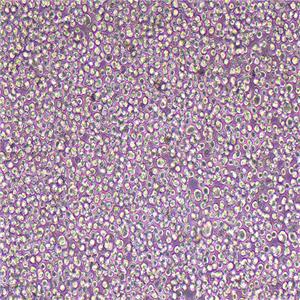Kasumi-1人急性原粒细胞白血病细胞