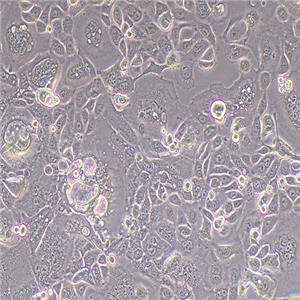 KLE人子宫内膜癌细胞（STR鉴定正确）