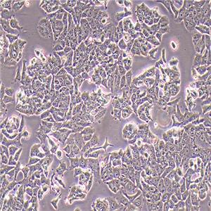 MCF-7人乳腺癌细胞（STR鉴定正确）