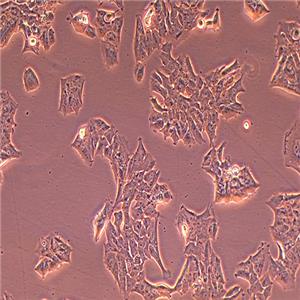 MDA-MB-361人乳腺癌细胞（STR鉴定正确）