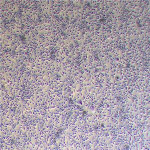 MDA-MB-436人乳腺癌细胞（STR鉴定正确）