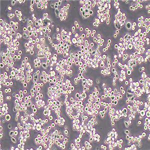 MDA-MB-453人乳腺癌细胞（STR鉴定正确）