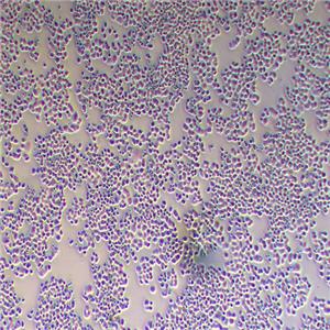 MDA-MB-468人乳腺癌细胞（STR鉴定正确）