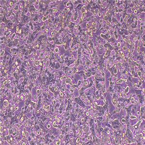 MHCC-97H人高转移性肝癌细胞（STR鉴定正确）