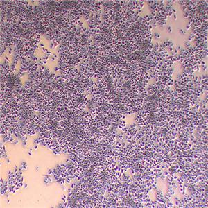 MIA-PACA-2人胰腺癌细胞（STR鉴定正确）