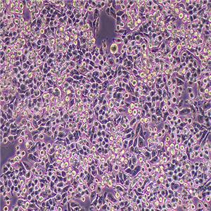 MIA-PACA-2人胰腺癌细胞（STR鉴定正确）
