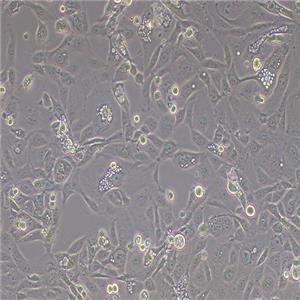 MKN-7人胃癌细胞（STR鉴定正确）