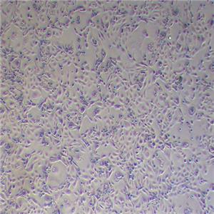 MKN-7人胃癌细胞（STR鉴定正确）