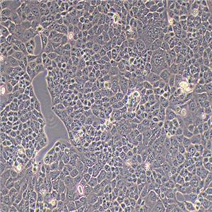 MKN-28人胃癌高转移细胞（STR鉴定正确）
