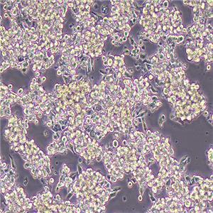 MKN-45人胃癌细胞（STR鉴定正确）