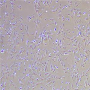 MRC-5人胚肺成纤维细胞（STR鉴定正确）