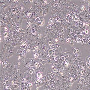 MS751人子宫颈表皮癌细胞（STR鉴定正确）