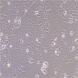 MS751人子宫颈表皮癌细胞（STR鉴定正确）