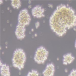 MT-4人急性淋巴母细胞白血病细胞（STR鉴定正确）
