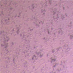 MV3人黑色素瘤细胞（STR鉴定正确）