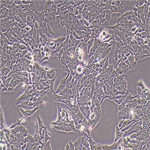 NCI-H358人非小细胞肺癌细胞（STR鉴定正确）