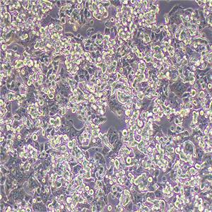 NCI-H520人肺鳞癌细胞（STR鉴定正确）