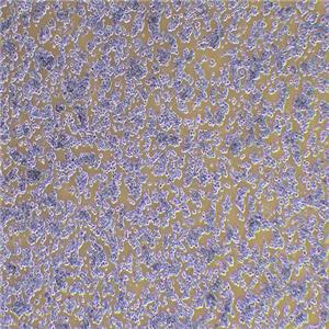NCI-H524人非小细胞肺癌细胞