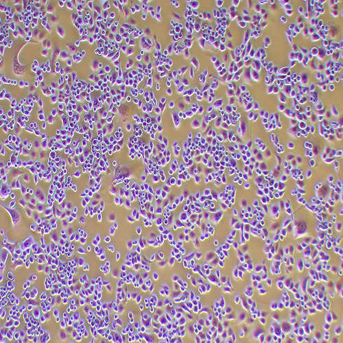 PANC-1人胰腺癌细胞（STR鉴定正确）