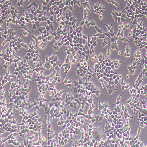 293T-LUC（人胚肾细胞-荧光素酶标记（STR鉴定正确））