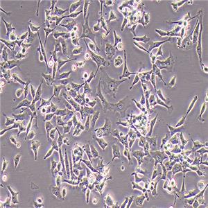 NCI-H446人小细胞肺癌细胞（STR鉴定正确）
