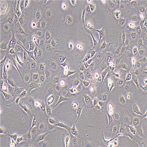 NCI-H1650人非小细胞肺癌细胞（STR鉴定正确）