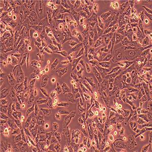 NCI-H1703人肺鳞癌细胞 (STR鉴定正确)