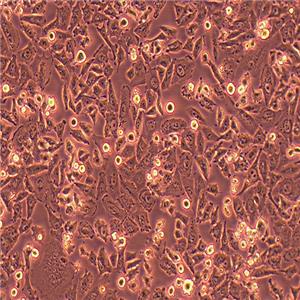 NCI-H1703人肺鳞癌细胞 (STR鉴定正确)
