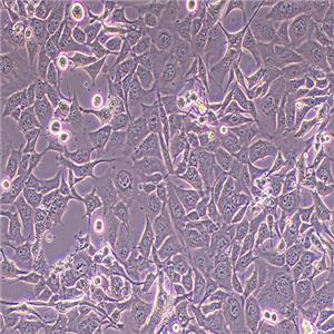 NCI-H1975人肺腺癌细胞（STR鉴定正确）