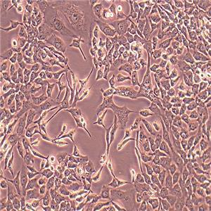 NCI-H2009人肺腺癌细胞（STR鉴定正确）