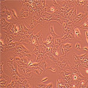 NCI-H2228人非小细胞肺癌细胞
