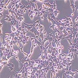 NCI-H3122人非小细胞肺癌细胞