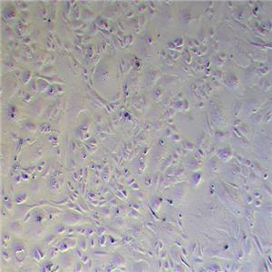 OS-RC-2人肾癌细胞（STR鉴定正确）