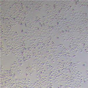 OVCAR-3人卵巢腺癌细胞（STR鉴定正确）