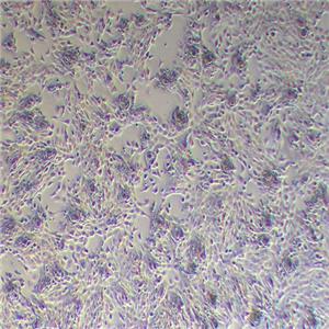 NIH:OVCAR-8 人卵巢癌腺癌细胞