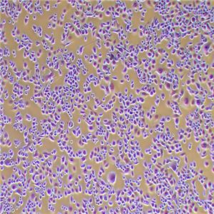 PANC-1人胰腺癌细胞（STR鉴定正确）