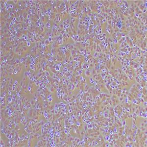 PLC/PRF/5人肝癌亚力山大细胞