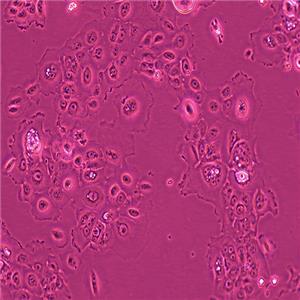 RWPE-1人正常前列腺上皮细胞（STR鉴定正确）