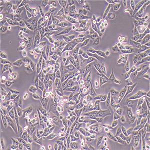 SF188人胶质母细胞瘤细胞（STR鉴定正确）