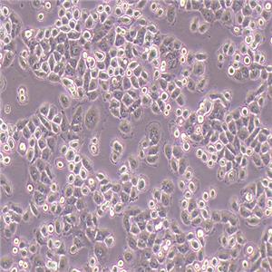 SGC-7901人胃腺癌细胞（STR鉴定正确）