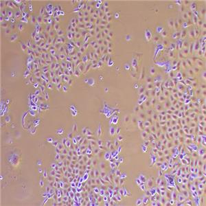 SUNE-1人低分化鼻咽癌细胞系