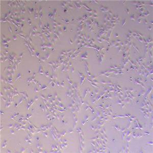 SV-HUC-1人输尿管上皮永生化细胞（STR鉴定正确）