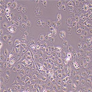 T24人膀胱移行细胞癌细胞（STR鉴定正确）