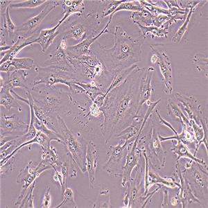 U-87 MG人脑星形胶质母细胞瘤细胞（STR鉴定正确）