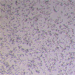 WPMY-1人正常前列腺基质永生化细胞（STR鉴定正确）