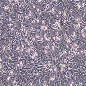 A375-LUC（人恶性黑色素瘤细胞-荧光素酶标记（STR鉴定正确））