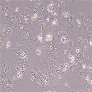 A431-LUC（人皮肤鳞癌细胞-荧光素酶标记（STR鉴定正确））