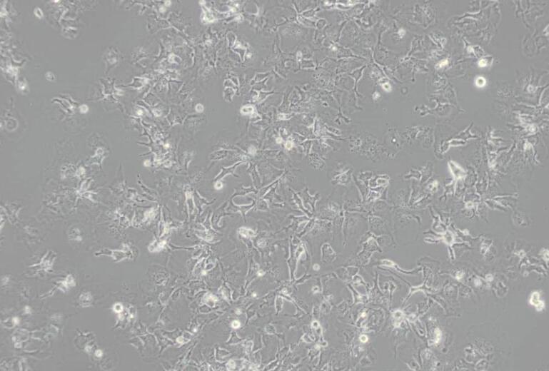 Hep 3B2.1-7（人肝癌细胞）,Hep 3B2.1-7