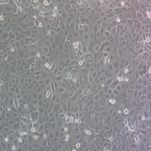 DU145-LUC-PURO（人前列腺癌细胞-荧光素酶标记（STR鉴定正确））